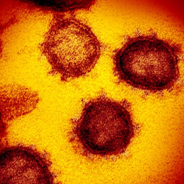 ویروس کرونا زیر میکروسکوپ